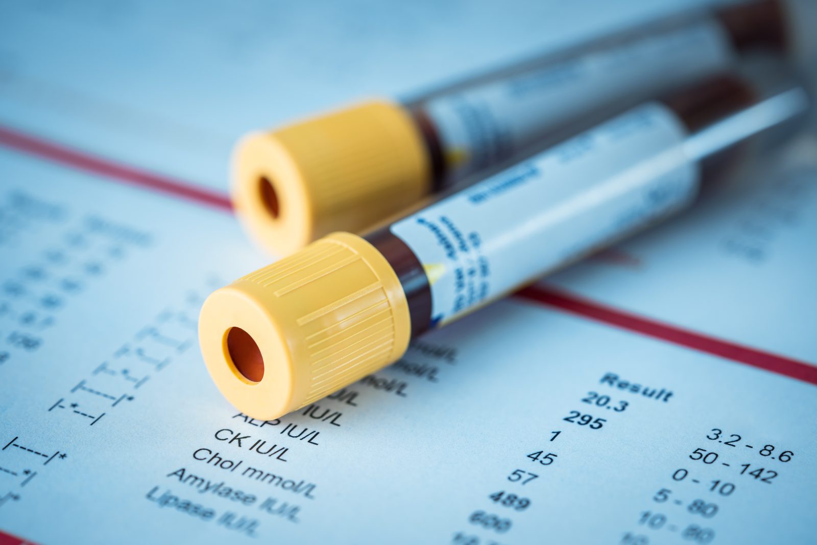 Clean, modern laboratory with blood draw equipment